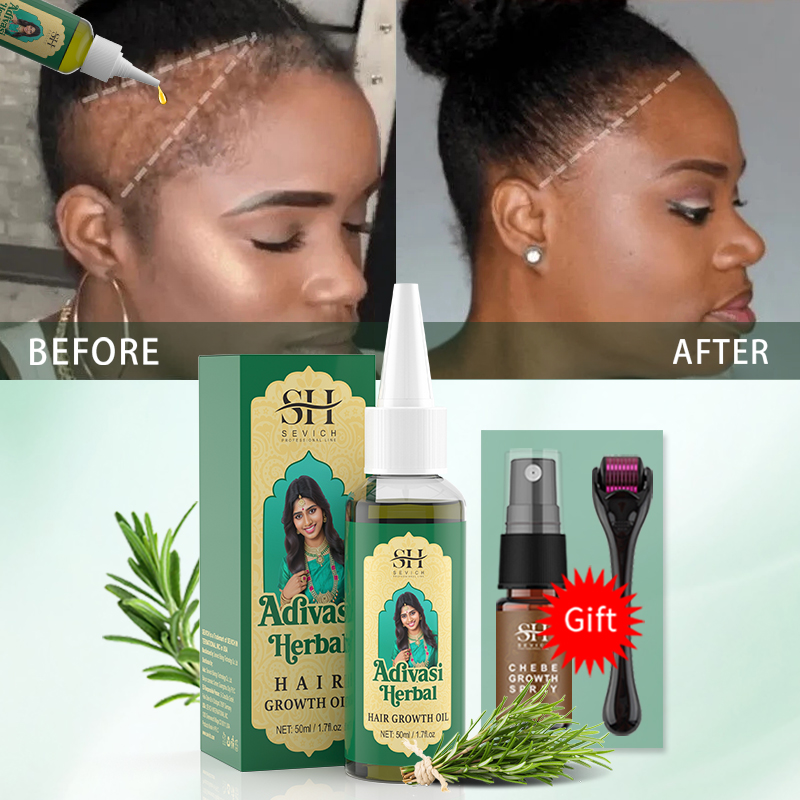 Ayurvedic Hair Growth Oil Indi - Ingrown Hair Serum 评论和价格