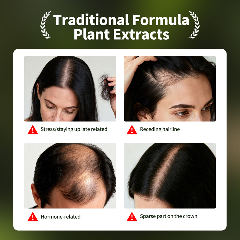 Natural Hair Growth Set Usman  - Ingrown Hair Serum 评论和价格