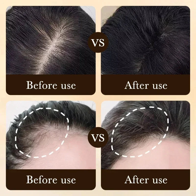 Biotin Fast Hair Growth Oil Pr - Ingrown Hair Serum 评论和价格