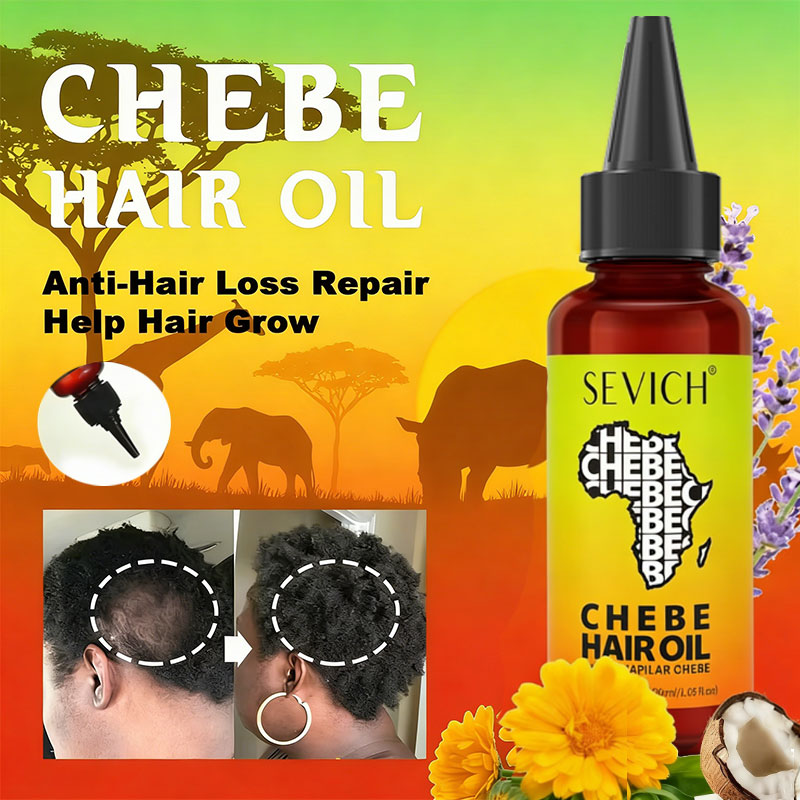 Chebe Fast Hair Growth Oil Afr - Ingrown Hair Serum 评论和价格