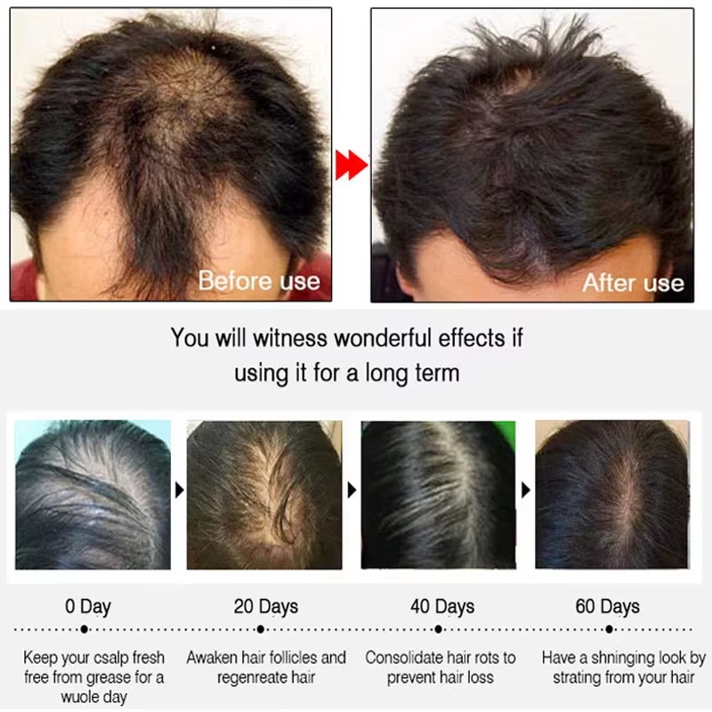 Fast Ginger Hair Growth Spray  - Ingrown Hair Serum 评论和价格