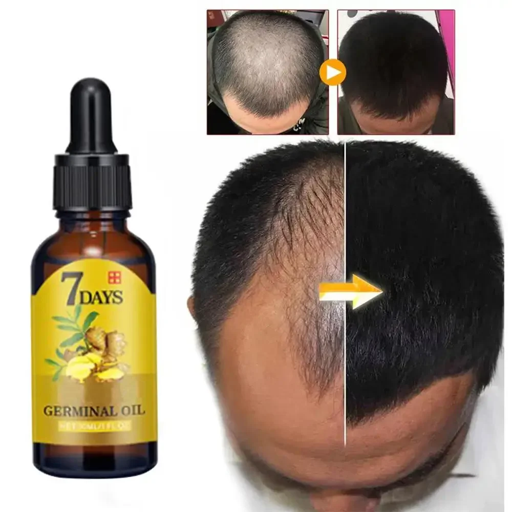 Hair Growth Ginger Fast Growin - Ingrown Hair Serum 评论和价格