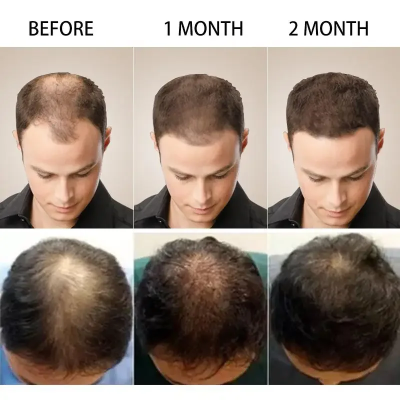 Hair Growth Ginger Fast Growin - Ingrown Hair Serum 评论和价格